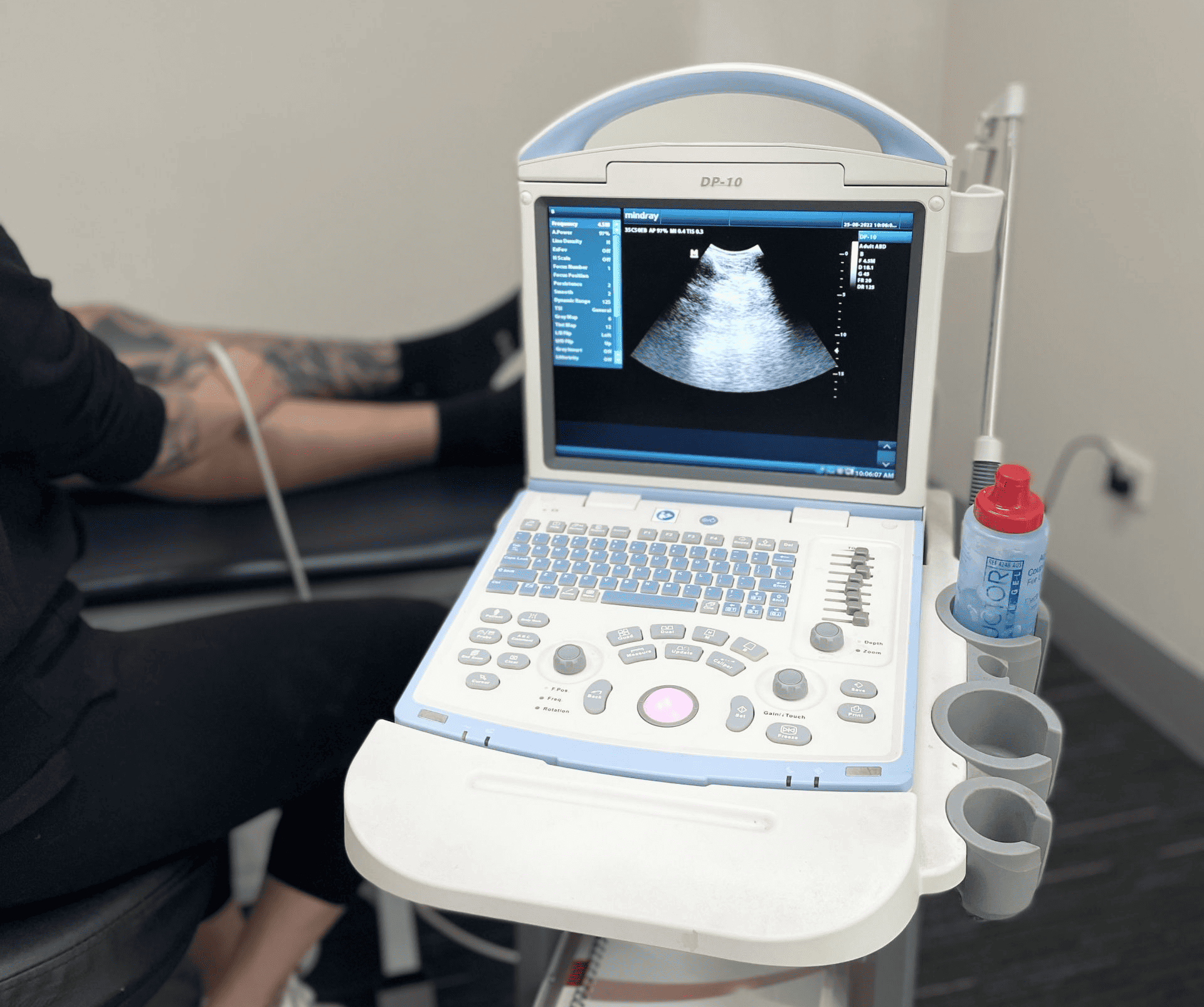Real-Time Ultrasound